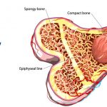 پیوند مغز استخوان