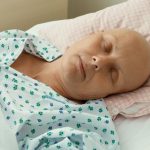 عوارض ناشی از شیمی درمانی