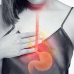 رفلاکس معده