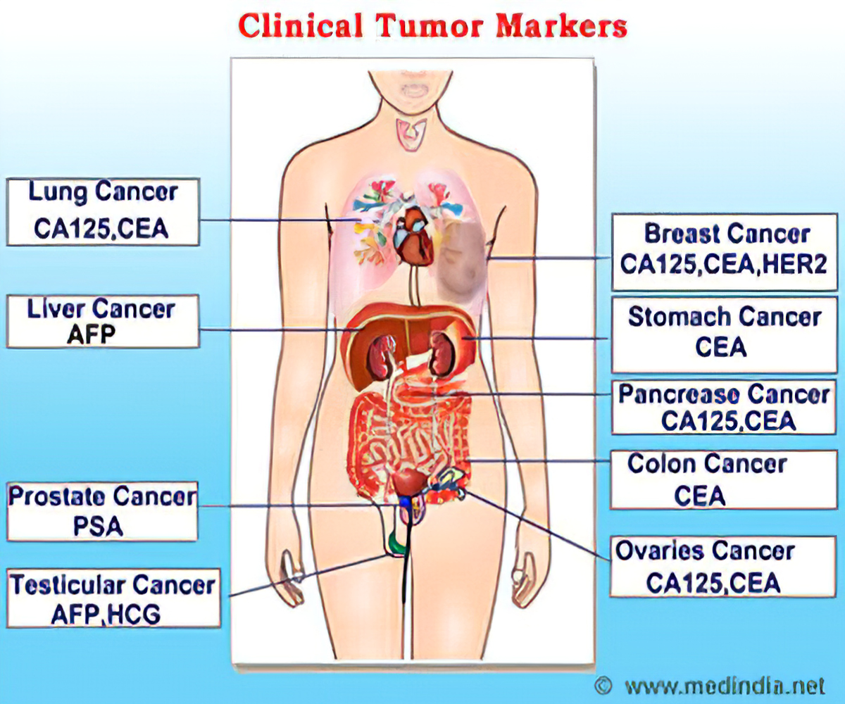 Tumor Markers 