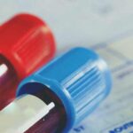 آیا فقر آهن باعث سرطان خون میشود