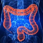 جلوگیری از سرطان معده و روده