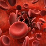 هموفیلی نوع A