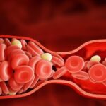 شایع ترین علائم انعقاد خون