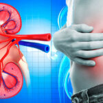 نشانه‌های سرطان کلیه