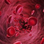 درمان تالاسمی ماژور