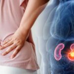 ارتباط بین کمردرد و سرطان کلیه چیست؟