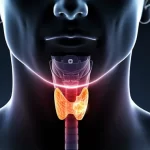 آیا سرطان تیروئید ارثی است؟