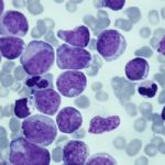 سرکوب مغز استخوان