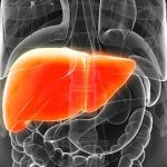 درمان متاستاز سرطان روده بزرگ به کبد