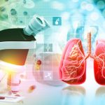 درمان هدفمند