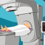 رادیوتراپی