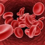 درمان تالاسمی