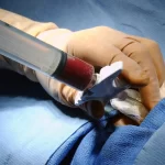 پیوند مغز استخوان برای چه بیماری هایی است